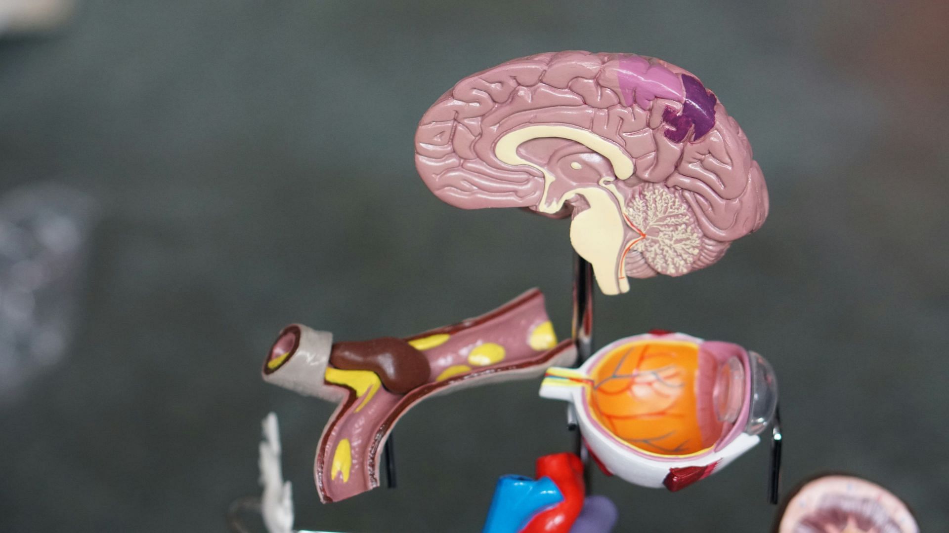 Glioblastoma (Image via Unsplash/ Robina Weermeijer)